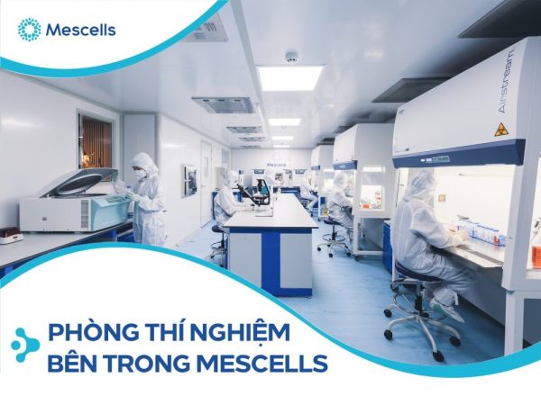 Khám phá hệ thống Laboratory bên trong Mescells Khám phá hệ thống Laboratory bên trong Mescells