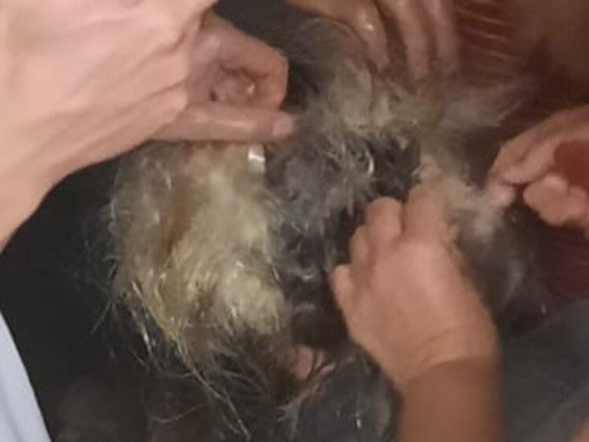 Du khách phải cắt gần hết tóc sau tai nạn lặn biển Du khách phải cắt gần hết tóc sau tai nạn lặn biển